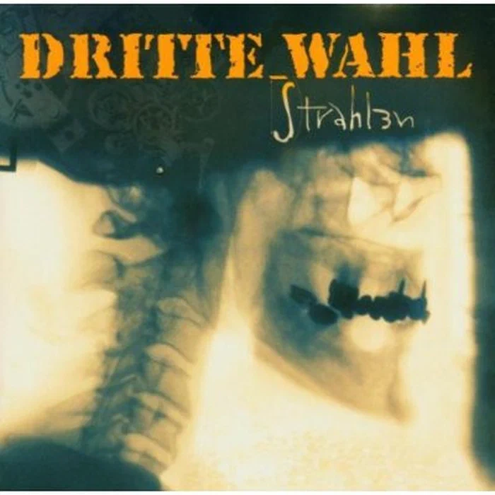 Dritte Wahl – Strahlen